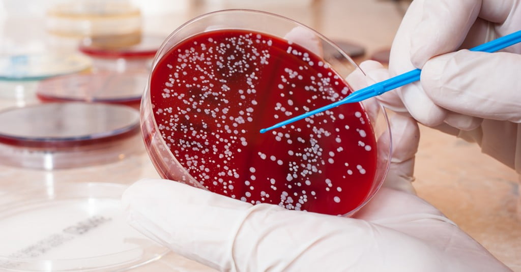 Global Blood Cancer Drugs Market Dynamics, Trends, Opportunities, Drivers, Challenges and Influence Factors Shared in a Latest Report 5