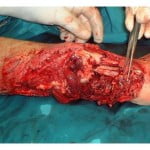 Pete Carroll Provides Injury Updates As The Seahawks Kick Off OTAs 3