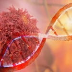 How long will someone with stage 4 colon most cancers live? 2