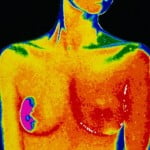 I Had a Preventive Mastectomy—Then Found Out I Already Had Breast Cancer 3