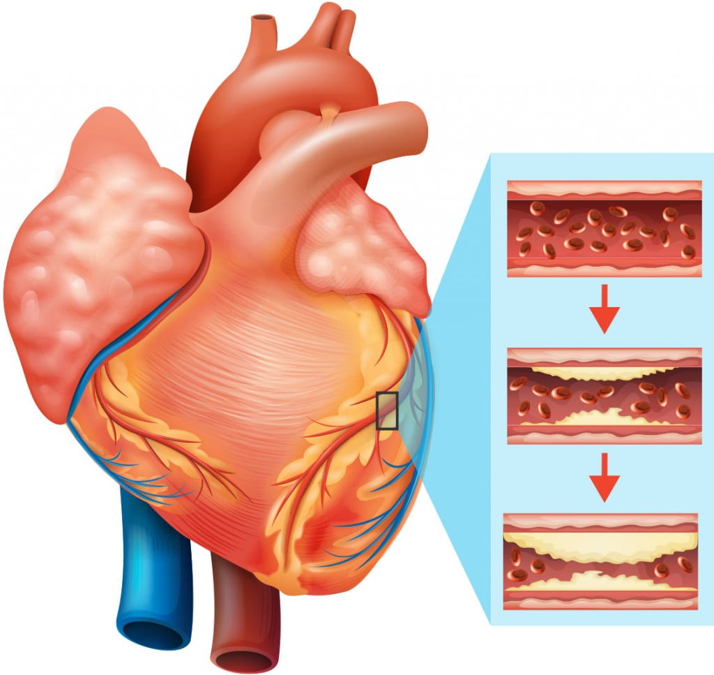 Aga Khan Hospital, Dar es Salaam (AKHD) treating coronary heart assaults 3