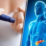 7 Myths About Diabetes People Somehow Still Believe 2