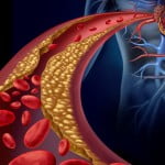 Heart failure missed in lots of women because medical doctors assume it is a 'man's sickness' 2