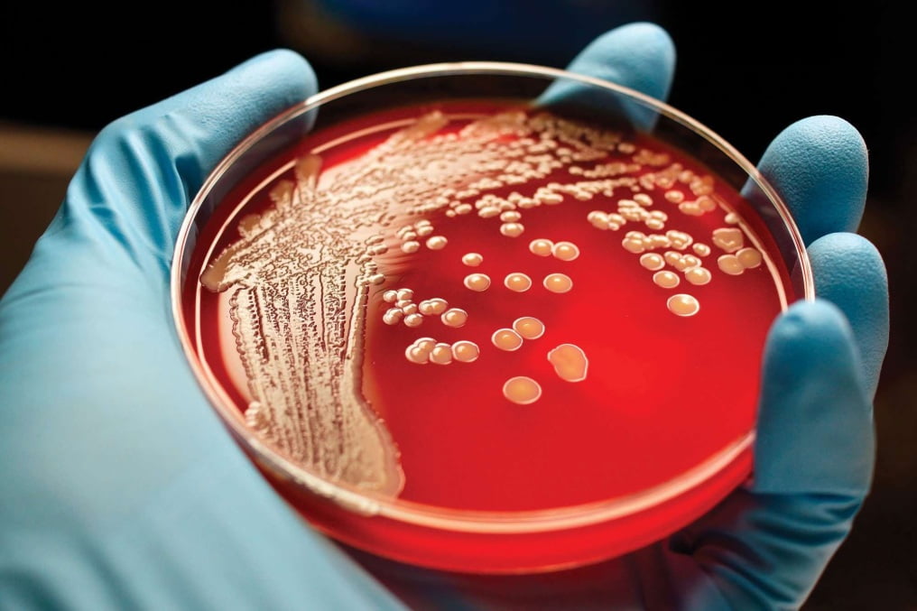 Blood Cancer Diagnostics Market 2019 Competitive Analysis like Abbott Laboratories, Roche Holding A.G., 3