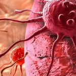 Disease-triggering Protein a Potential Achilles' Heel of Blood Cancer 3