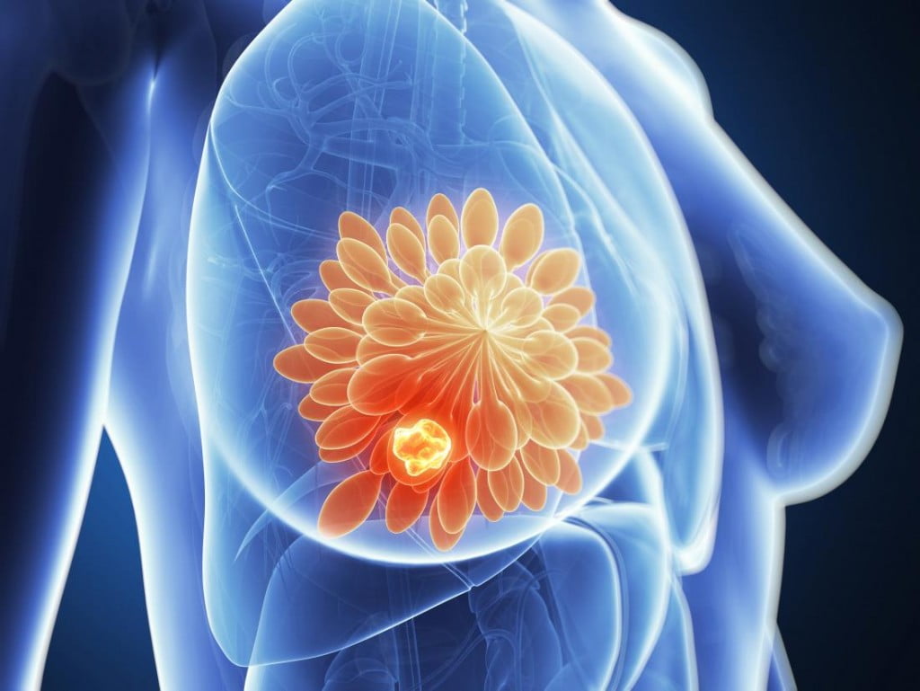 Merck’s Keytruda fails triple terrible breast cancer pivotal study 7