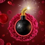 Blood most cancers sufferer from Walsall has 'lifesaving op' 2