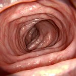 10 Breast Cancer Myths You Need to Stop Believing 3