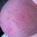 New research unearths a low-fats food regimen can decrease a woman's hazard for breast cancer 2