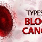 Beer Stores, union to collect empties throughout Ontario in fight to stop blood cancer 3