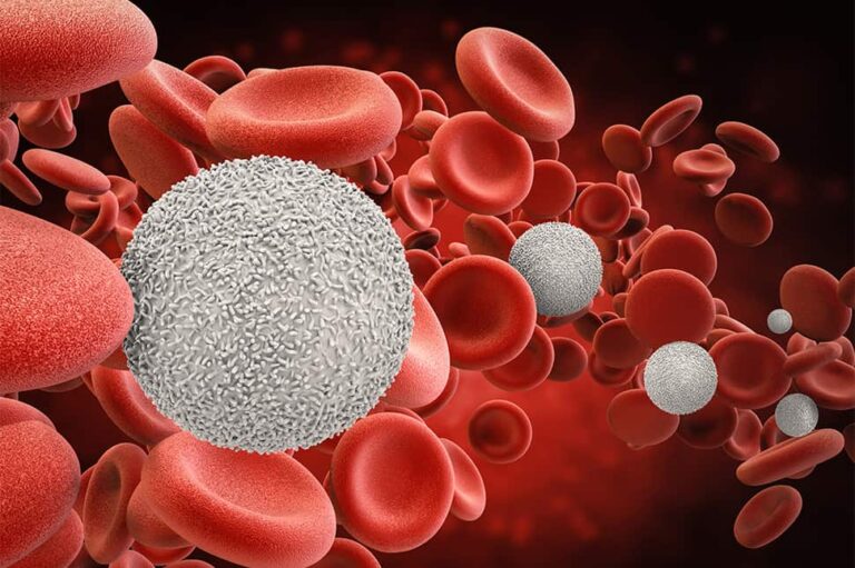 Signs of Blood Cancer - What Are They? 6