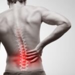 Pinched Back Nerve - What Is It? 2