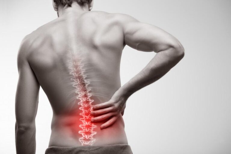 Pinched Back Nerve - What Is It? 9