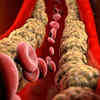 What Cholesterol Is Bad? 4