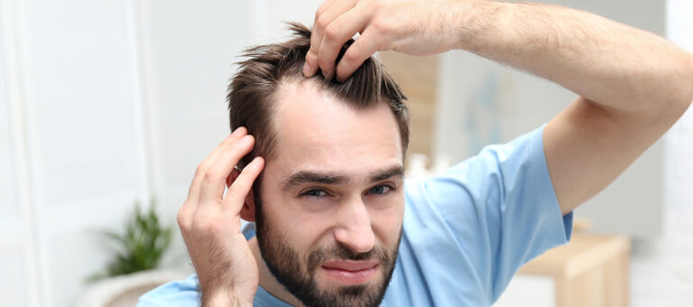 Self-Care Amidst Hair Loss: 6 Tips to Prioritize Your Well-Being as a Young Man 3