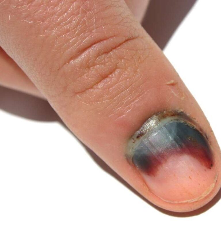 Decoding the Symbolism of Black Fingernails 9